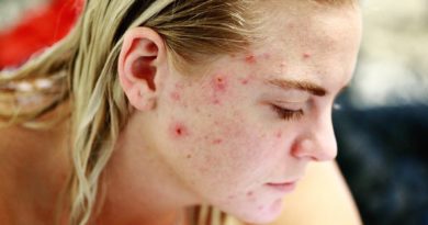 Struggle Acne Self Love Skin Face  - SharonMcCutcheon / Pixabay